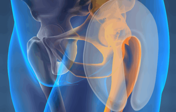 Safehip AirX Male - Image 2